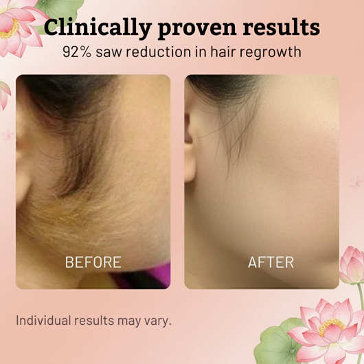 Cyperus Rotundus Oil