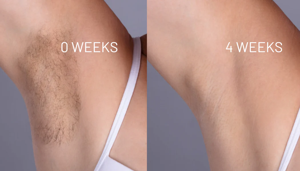 Die natürliche Lösung für